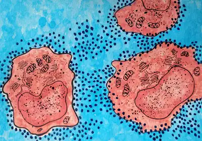 Cells affected by viruses. Here, T-lymphocytes are depicted as being affected by Human Immunodeficiency Virus (HIV) particles. © Sunaina Rao.