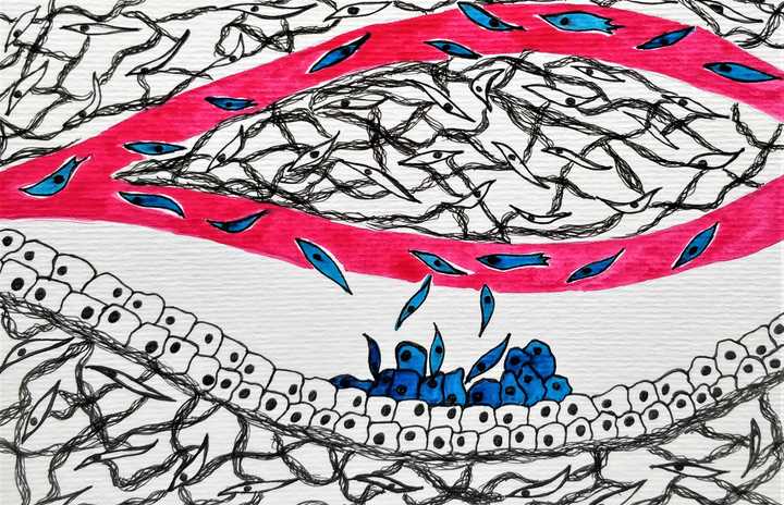 On reaching a suitable site, the cells that painstakingly survive the journey, move out, interact with the microenvironment and establish a metastatic growth. © Sunaina Rao. Tumour metastasis