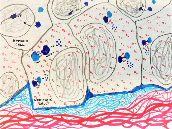 In the normoxic cells, oxygen helps hydroxylate the proline residues in HIF1 α (dark blue), which then interacts with VHL (light blue), thereby leading to the proteolysis of  HIF1 α. Whereas in hypoxic cells, the  HIF1 α remains intact and hence enters the nucleus and brings about transcription. © Sunaina Rao.