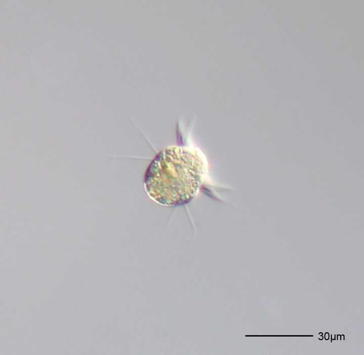 A unicellular organism belonging to the *Halteria* genus. Credit: [Wikimedia](https://commons.wikimedia.org/wiki/File:Halteria_grandinella_-_160x_(14069352174).jpg).