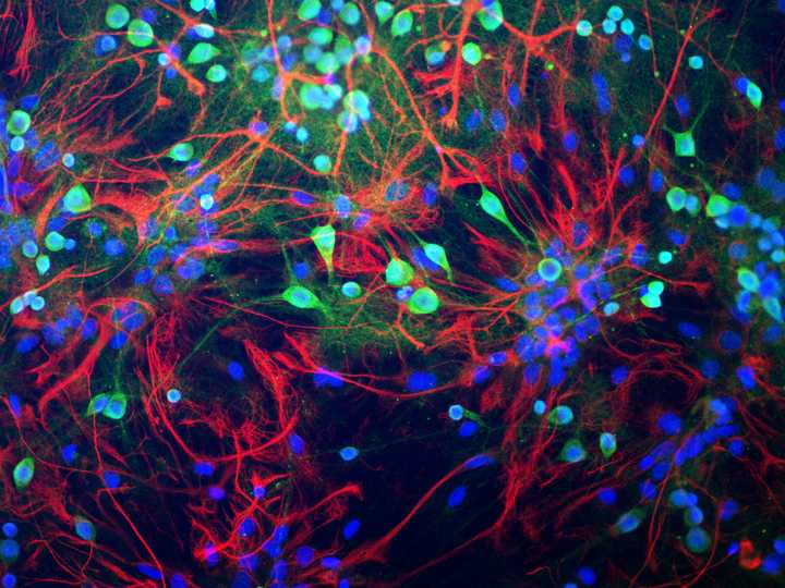 Neurons from a rat brain tissue as observed under a microscope. Each green and blue bulb-like structure is a neuron’s cell body. The red thread-like structures emerging from the cell body are its branches. These help in making connections with other neurons. Credit: [Wikimedia](https://commons.wikimedia.org/wiki/File:Chk-UCH1-GFAP-20X-1.jpg).